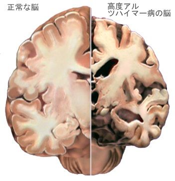 2ef1a7e3178ed0fdf3977897277c5538