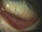lash