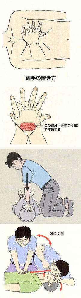 心肺蘇生法 心臓マッサージ