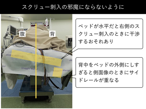 側臥位PPSblog.001