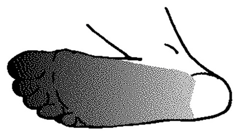 49