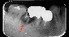 2016-9-1