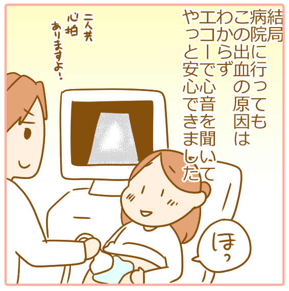 双子妊娠、不正出血05
