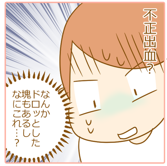 双子妊娠、不正出血02