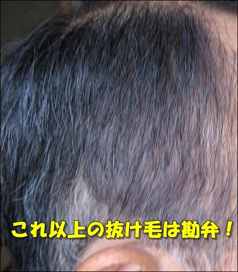 髪にボリュームがなくなったら危険信号 花蘭咲 からんさ は男性型脱毛症でも改善なるか 体験検証ブログ