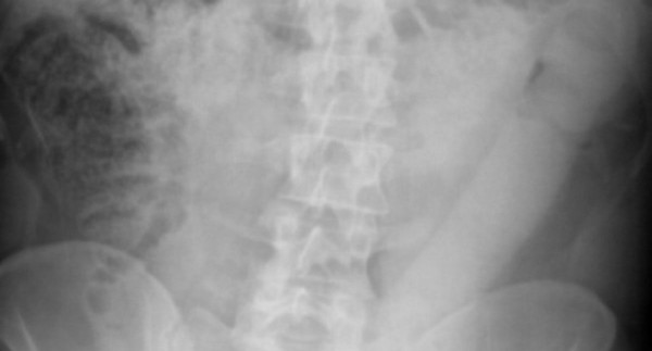NEWusenewbmj_640x345_acf_cropped-1-min