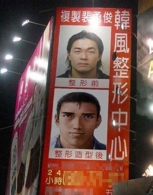 整形