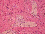 Auerbach plexus