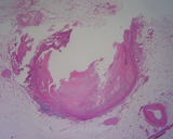 LC��