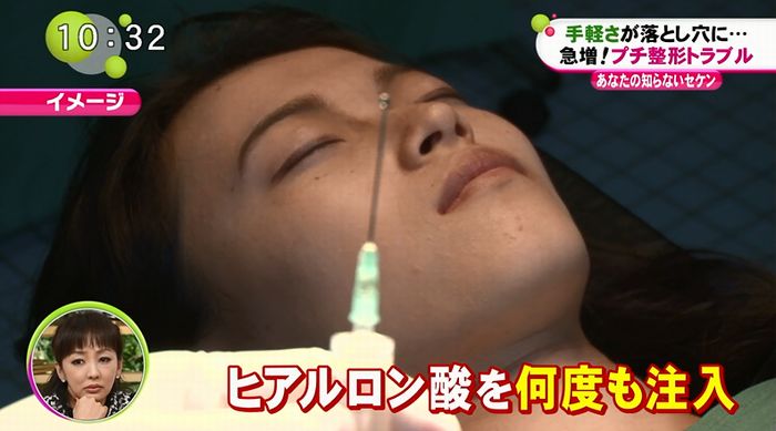 ノンストップのキャプ109
