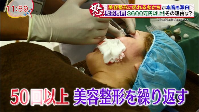 バイキング(美容整形に怒る女達が生出演)のキャプチャ44