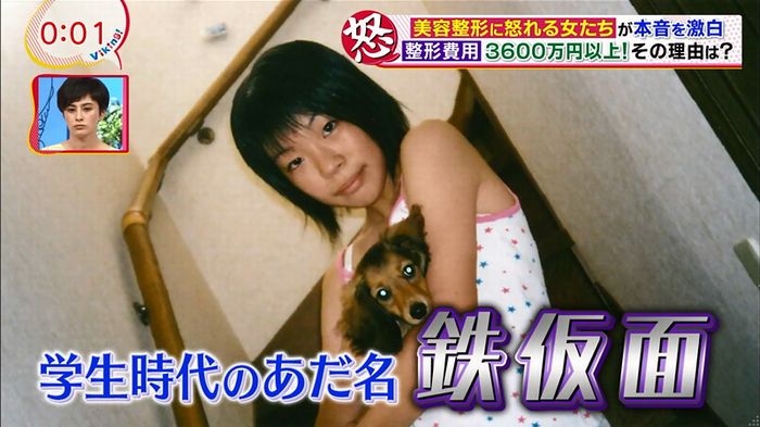 バイキング(美容整形に怒る女達が生出演)のキャプチャ62
