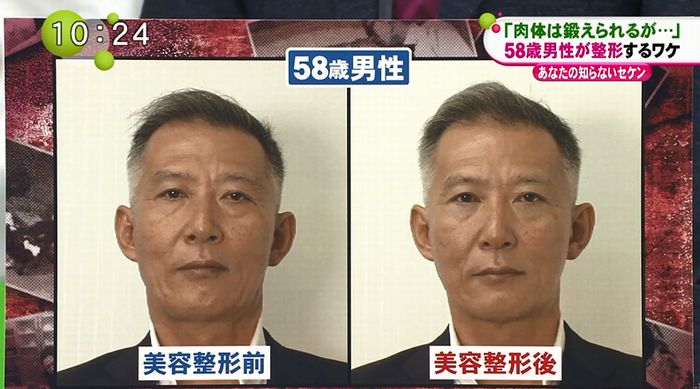 ノンストップのキャプ65