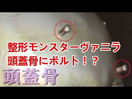 ダウンロード