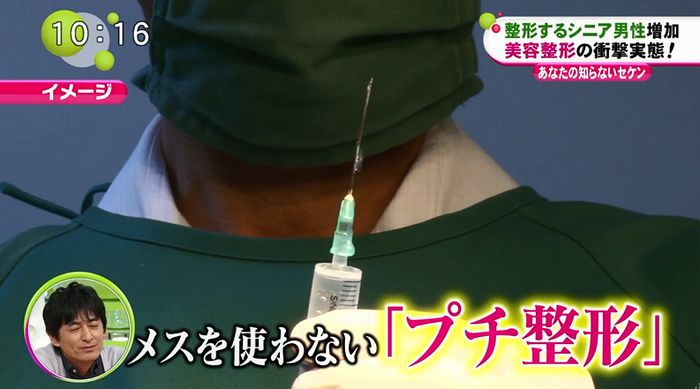 ノンストップのキャプ11
