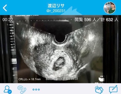 「15歳のカリスマネット配信者「渡辺リサ」、彼氏との妊娠中絶を告白し大炎上」という記事の見出し画像