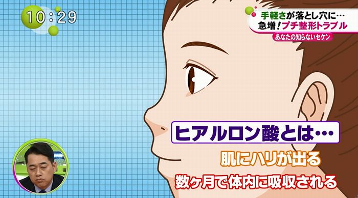 ノンストップのキャプ84