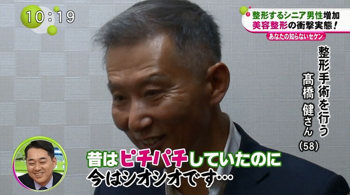 ノンストップのキャプ30