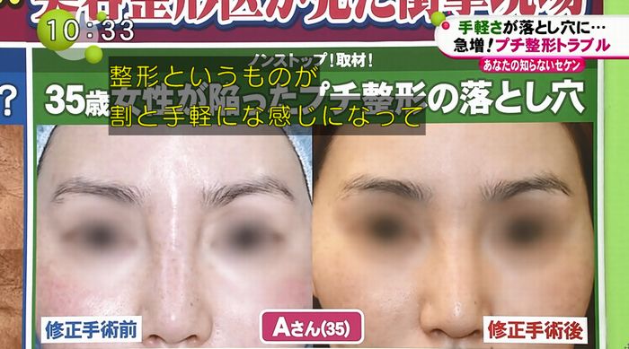 ノンストップのキャプ117