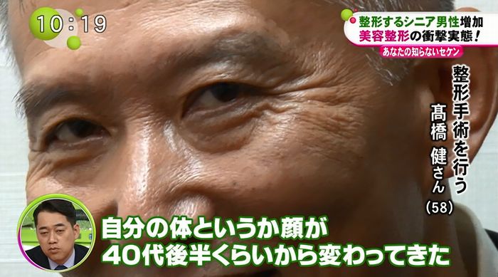 ノンストップのキャプ29