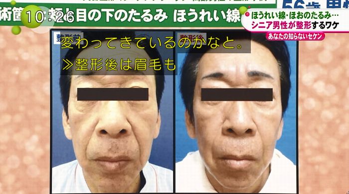 ノンストップのキャプ67