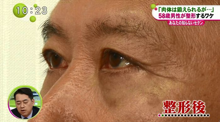 ノンストップのキャプ59