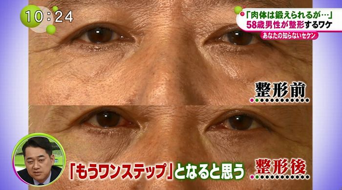 ノンストップのキャプ63