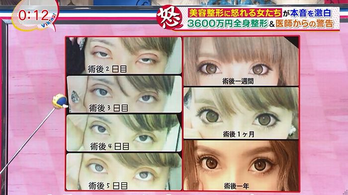 バイキング(美容整形に怒る女達が生出演)のキャプチャ80