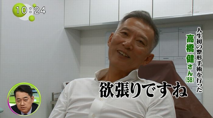 ノンストップのキャプ64