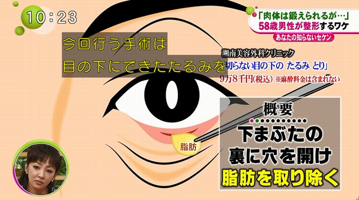 ノンストップのキャプ54