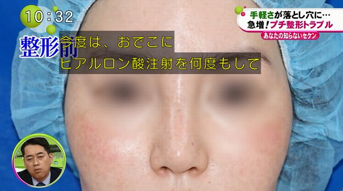 ノンストップのキャプ110