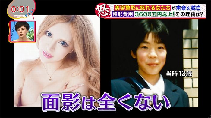 バイキング(美容整形に怒る女達が生出演)のキャプチャ57