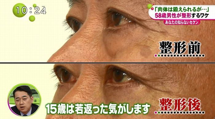 ノンストップのキャプ60