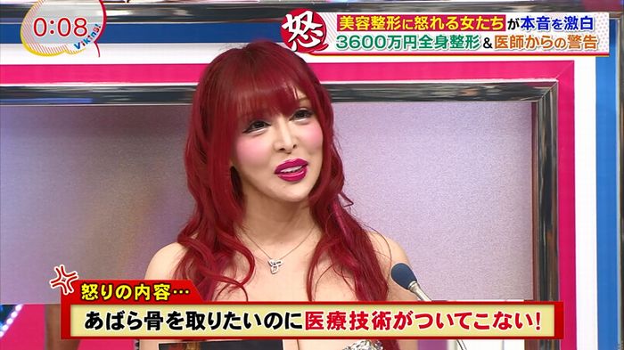 バイキング(美容整形に怒る女達が生出演)のキャプチャ74
