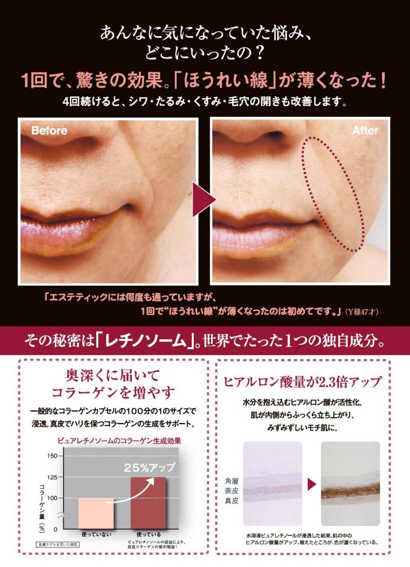 大好評!!ﾀﾞｲﾚｸﾄﾊﾟﾌｫｰﾏﾝｽ : Gecca