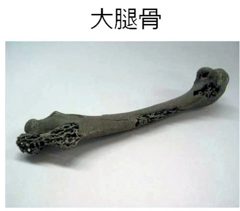 チタンの骨