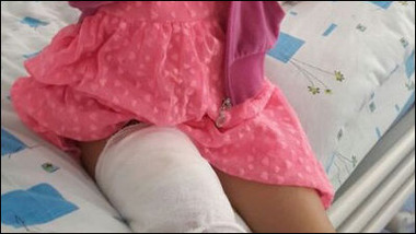 7歳の少女のスマホが爆発