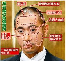ダウンロード (12)
