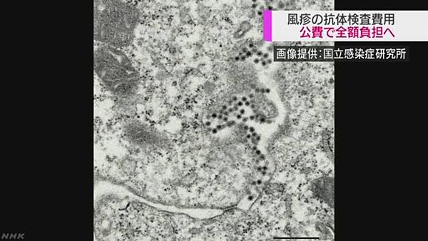 【風疹感染拡大】抗体検査費用、公費で全額負担へ 30代から50代男性対象=厚労省、5都県に緊急通知