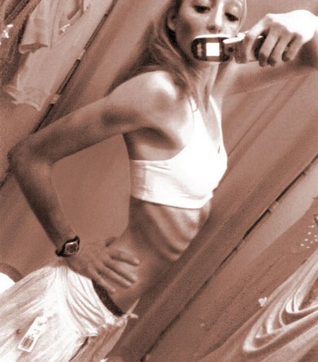 anorexic-models-17