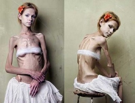 anorexic-models-05