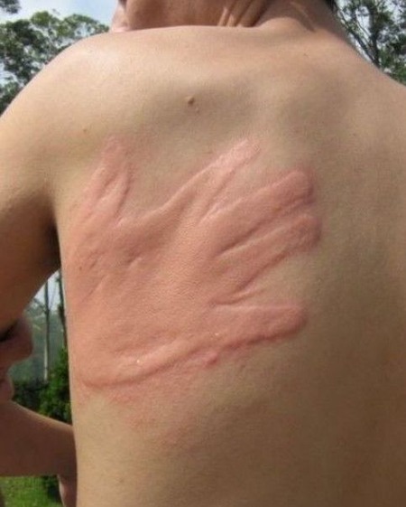 Nice_Slap_Mark