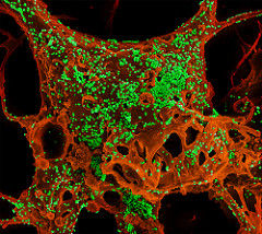 MERS Coronavirus Particles¡¡photo:NIAID¡¡CC BY 2.0¡ÊFlickr)
