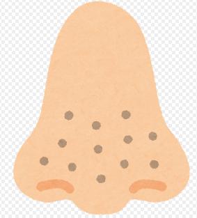 s1