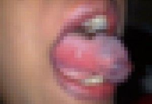 【閲覧注意】この女の子の「舌」ヤバくない？（画像）