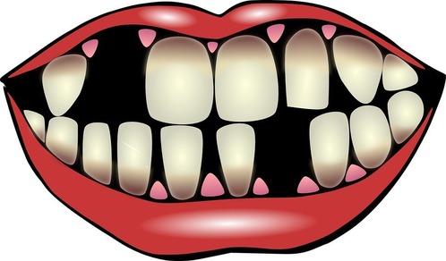 dental-hygiene-156103_960_720