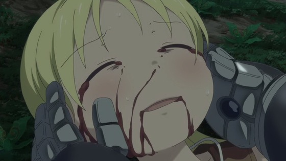 00300