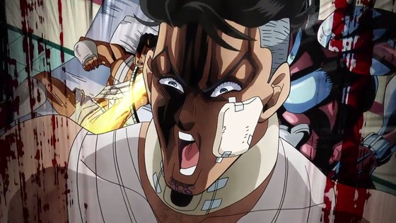 00423