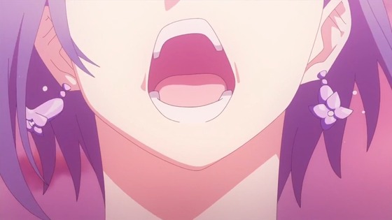 00399