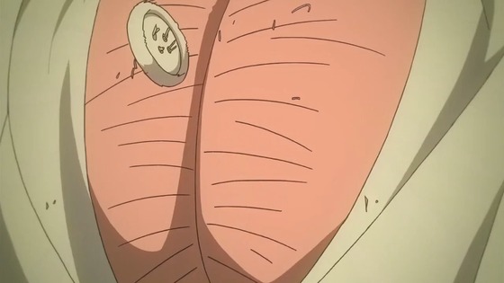 00028